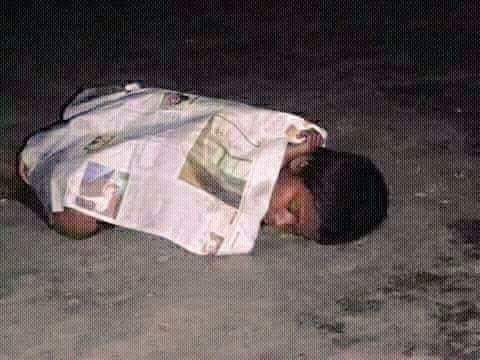 anuradha898's tweet photo. @deepsrock0922 hope you are luckiest than this child,pain is temporary #lifewithhope :) https://t.co/zpd7L8q45F