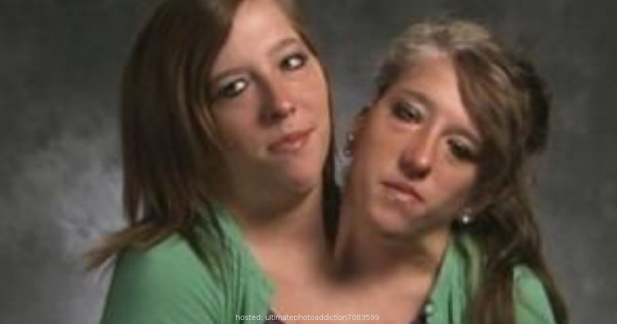 Female Twins Having Sex - Conjoined twins have sex - New porno