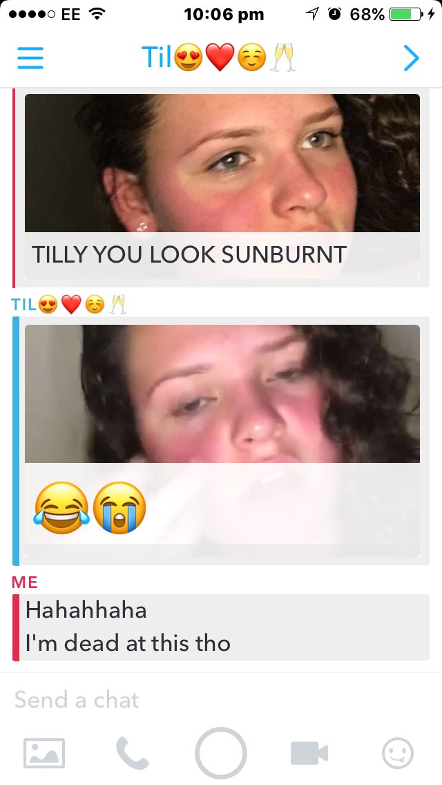 Daisyjaynexo's tweet photo. Today , @TilLongbottom learnt that one exfoliator at a time really is enough . #prayfortilly #sendaloefortilly #useice?? https://t.co/xcx9qHKIZn