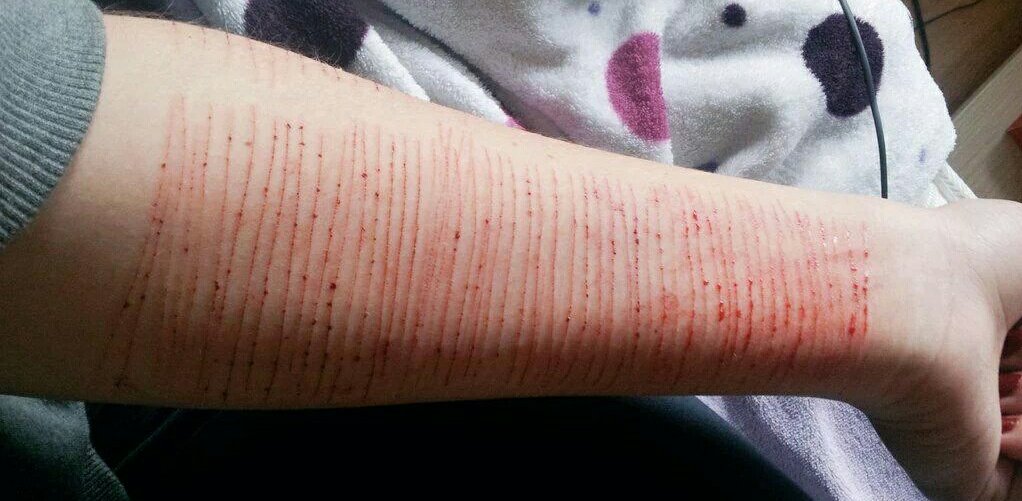 Scars_Addiction's tweet image. Después de 2 años, lo echaba de menos