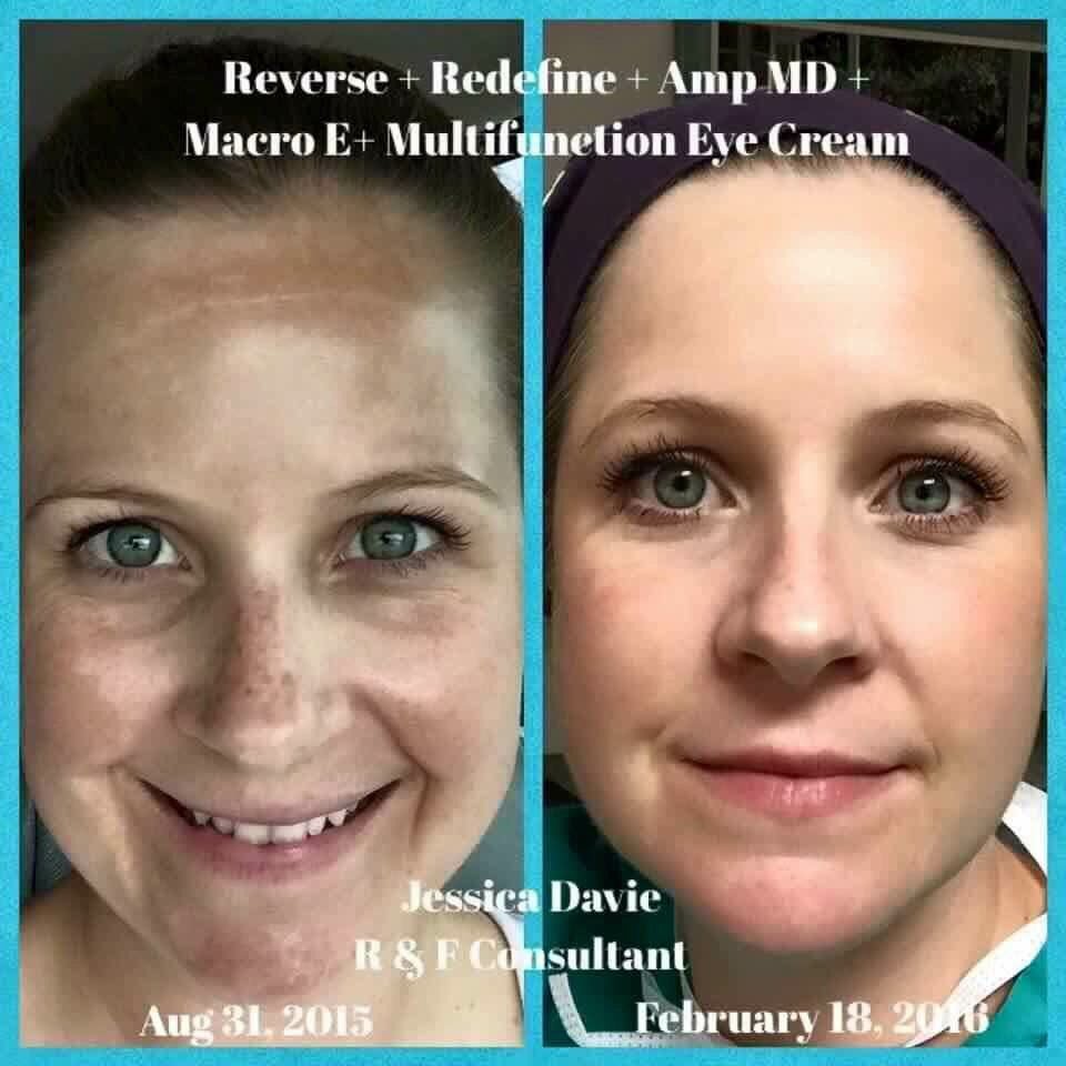 JWRN80's tweet photo. Products that actually work!! Start loving your skin! #rodanandfields #nomakeup #nofilter https://t.co/TXI5hAcBBE