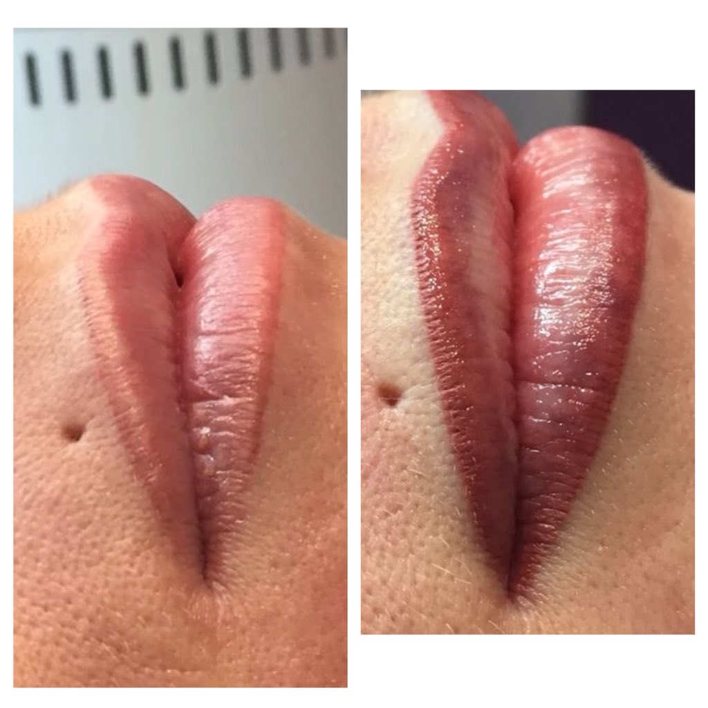 FaceFacts2's tweet image. Semi-permanent Lip Liner Before and After..