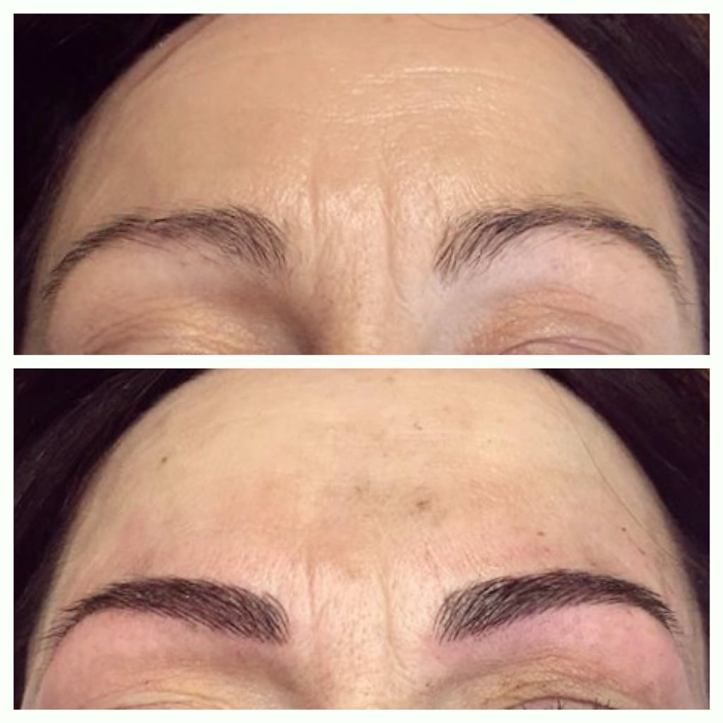 FaceFacts2's tweet image. Semi-permanent Feathered Eyebrows before and after..