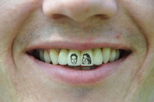 Dentagama's tweet photo. What is Tooth Tattoo? https://t.co/XcfvsfJgPd
#toothtattoo
#teethtattoos https://t.co/Gpp5JiXkEm