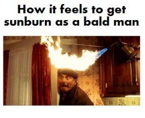 BaldGuyz's tweet image. Why skin care is so important #HomeAlone #BaldHumor #Sunburn #Humor #Funnies #Sunscreen #BaldGuyz #GelProtection