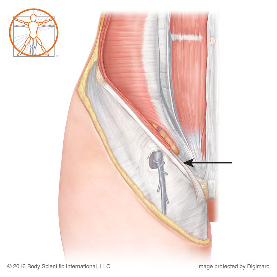 Round Ligament Anatomy