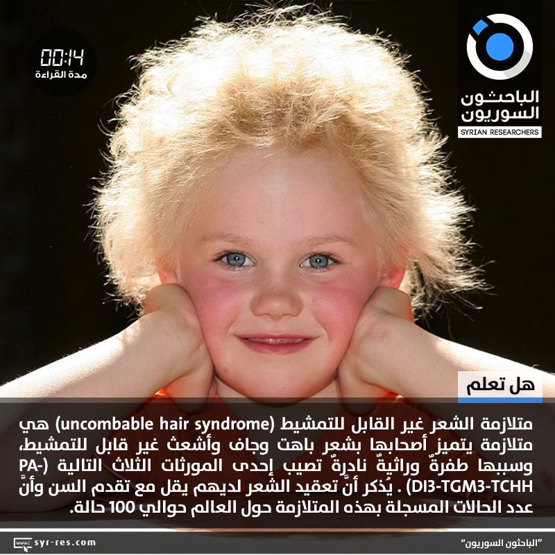 wa3i__'s tweet photo. هل سمعت بمتلازمة الشعر غير القابل للتمشيط ! https://t.co/AYuRYig5RO