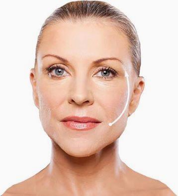 HBHealthClinic's tweet image. SAGGY SKIN NO MORE! #silhouettesoft #SkinRenewal #facialthreads #antiageing hbhealthofknightsbridge.co.uk/thread-lift/
