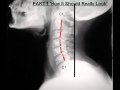 andrewyoder1977's tweet photo. Dr Paula Moore posture doctor shows you an xray of 'perfect' neck posture. https://t.co/82eOSWtb7C https://t.co/OzETcudT21