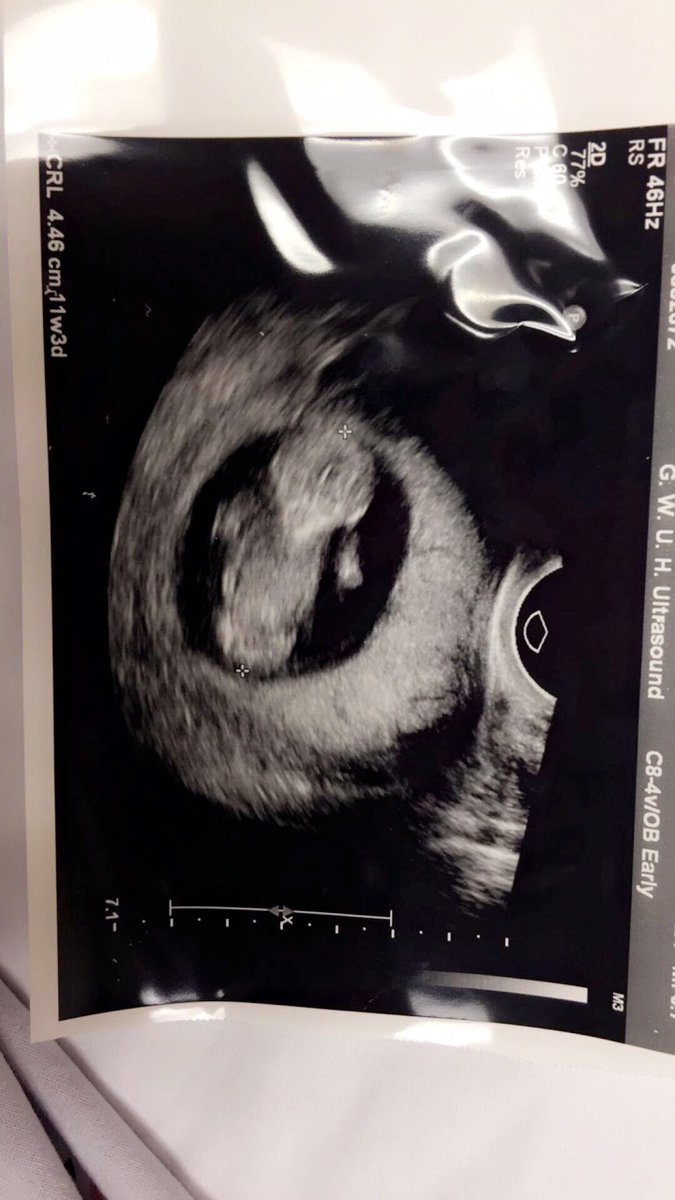 CurveGawd's tweet photo. My baby getting so big 😩❤️ Mommy and Daddy can't wait to meet you ! And your grandmothers 😂💜 https://t.co/rOumnb5B40