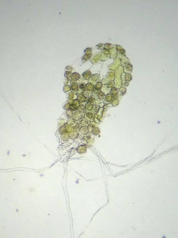 MLinkPerez's tweet photo. Male #gametophyte of #C-fern showing abundant male sex organs #antheridia almost bursting w/sperm cells; hairlike structures are #rhizoids https://t.co/K28jB3Alil