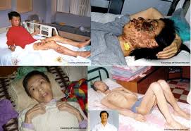 Mike77062267's tweet photo. @PDChina Communist China harvests organs from alive Chinese to sell for money 邪恶共匪

https://t.co/d7IIq2DDru https://t.co/i1oBm9Q8VJ