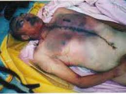 Mike77062267's tweet photo. @PDChina Communist China harvests organs from alive Chinese to sell for money 邪恶共匪

https://t.co/d7IIq2DDru https://t.co/i1oBm9Q8VJ