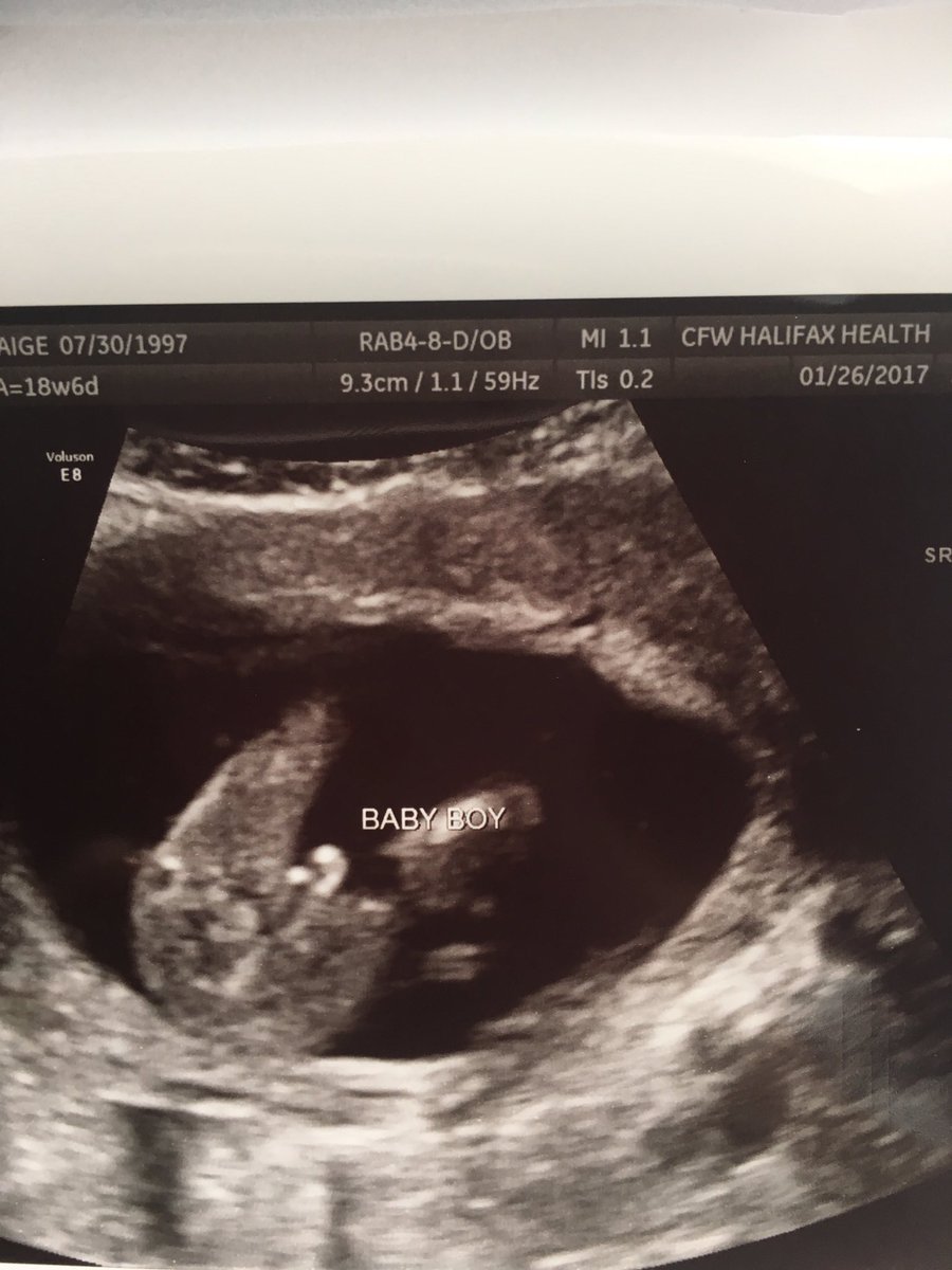 prandall351's tweet photo. My blessing coming July 13th❤ my baby boy 😍 @alexandercenti https://t.co/ra49TCOX6i