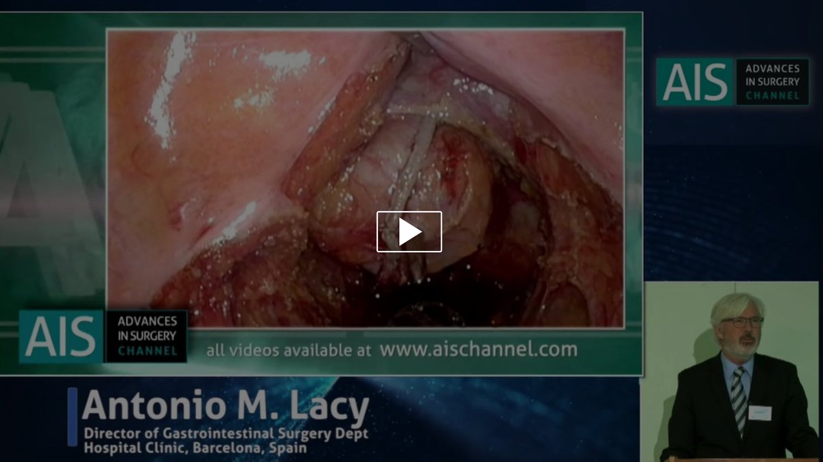 AntoniodeLacy's tweet photo. #TaTME – Video presentation https://t.co/fmNr2ZZ24D #colorectalsurgery #Barcelona #CecilApproach #education #worldwide #innovation https://t.co/Z3b4mKnobr