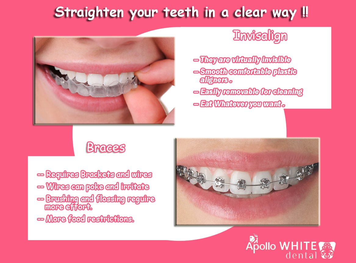 Apollo White Dental (@apollo_dental) | Twitter