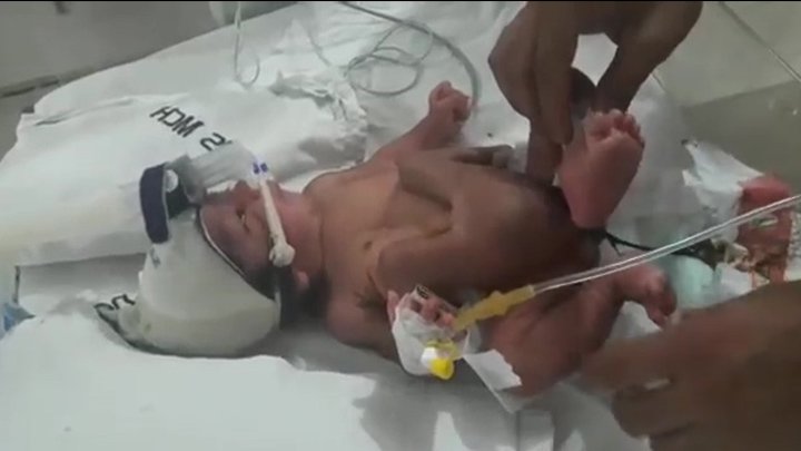 photo penis enfant Facial chicago illinois