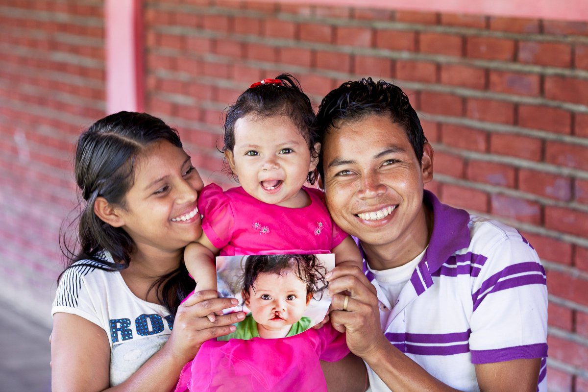 operationsmile's tweet image. In just one #surgery, volunteers repaired Valeska’s #cleft, giving her a new smile
in time for her 1st birthday! bit.ly/ValeskasStory
