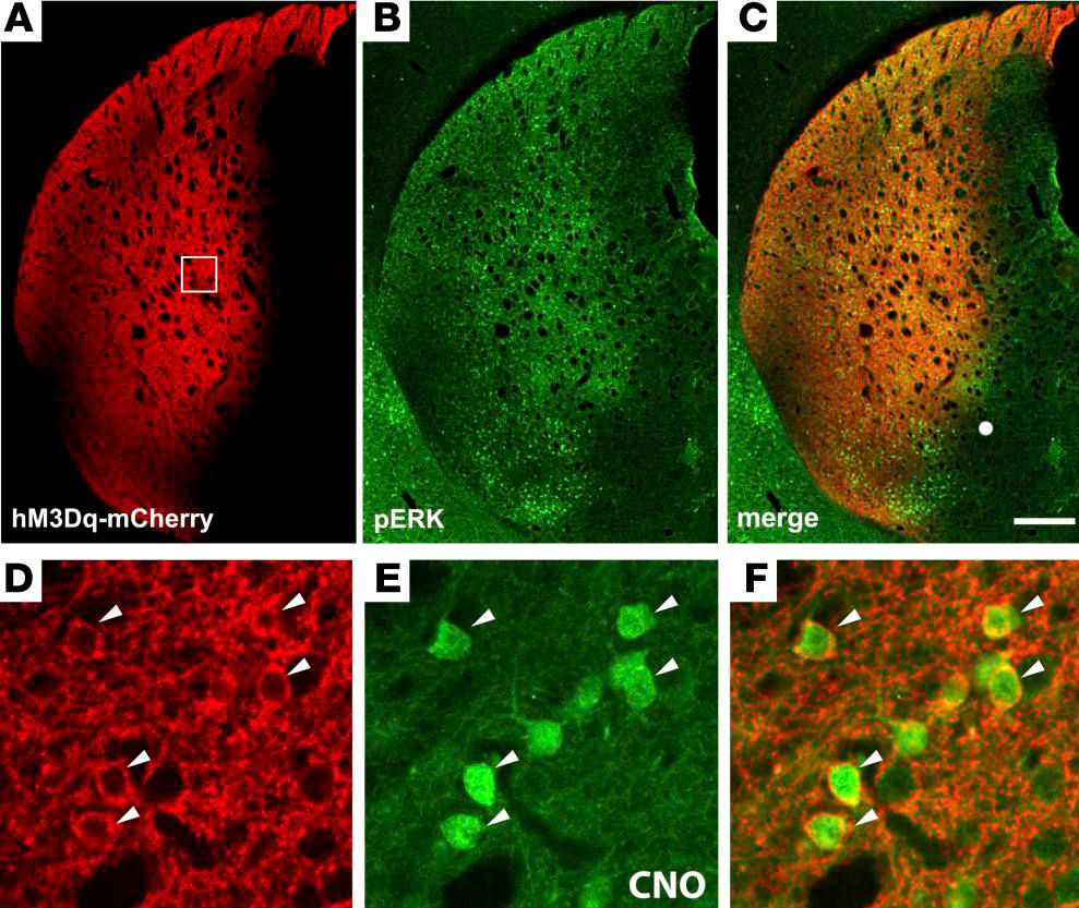 jclinicalinvest's tweet photo. Distinct striatal pathways contribute to therapy response in Parkinson’s disease https://t.co/xKDrkSLtZZ @LundUniversity #neuroscience https://t.co/hplY0yNKRq