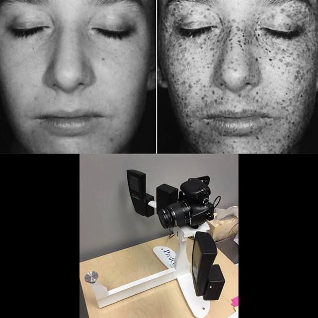 MD_Spa's tweet photo. MDSpa can take photos with our #Profect camera system that allow us to treat not only your present skin, but your future skin as well! https://t.co/jDMISvTaX1