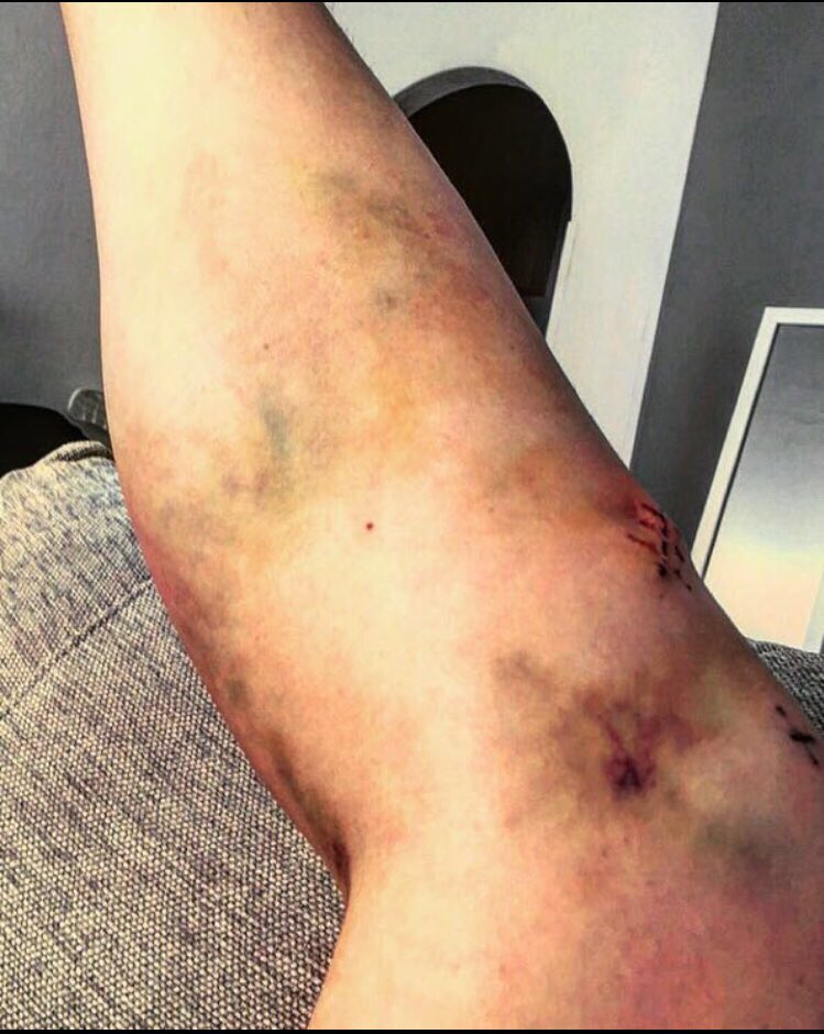 allu8's tweet photo. 10kk sitten oli tilanne tämä, mutta elämässä on se hieno puoli, että tilanteet muuttuu! #salibandy #backontrack #jataasmennään https://t.co/AXJZ9Lk5vb