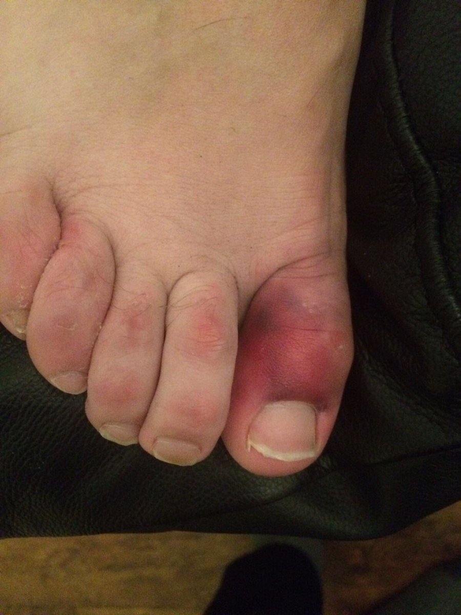 alveleycc's tweet photo. First cricket net and......ouch! #useyourbat #cricketcountdown https://t.co/8pZdT5jeZL
