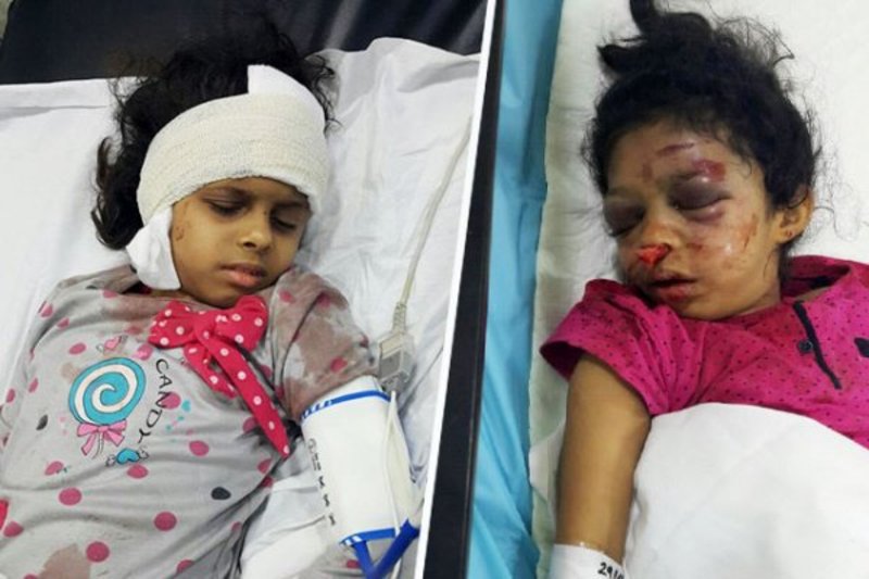 Against_violenc's tweet photo. خادمة تضرب رأسَيْ طفلتَيْن في الجدار بوحشية.. وتعتدي على الأم حين حاولت إنقاذ ابنتَيْها في جيزان 
https://t.co/U5wKFdPpwN https://t.co/ScfGJThUpX