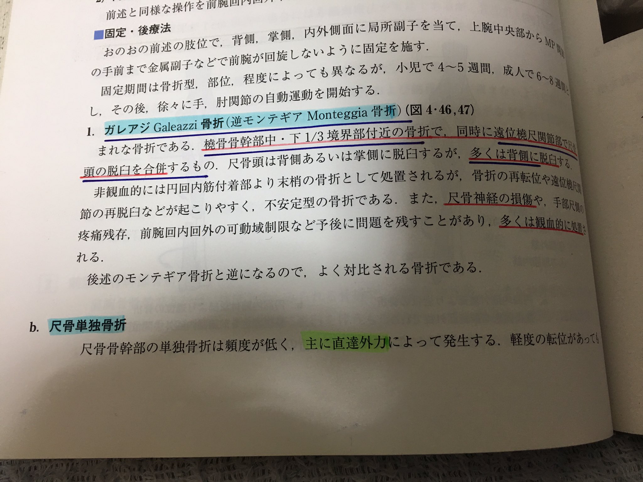 טוויטר 餅々くん בטוויטר Tjmiim ガレアジ骨折も円回内筋付着物より遠位の骨折となります 肘関節屈曲位 前腕回内回外中間位となります T Co Jbmrudi1ox