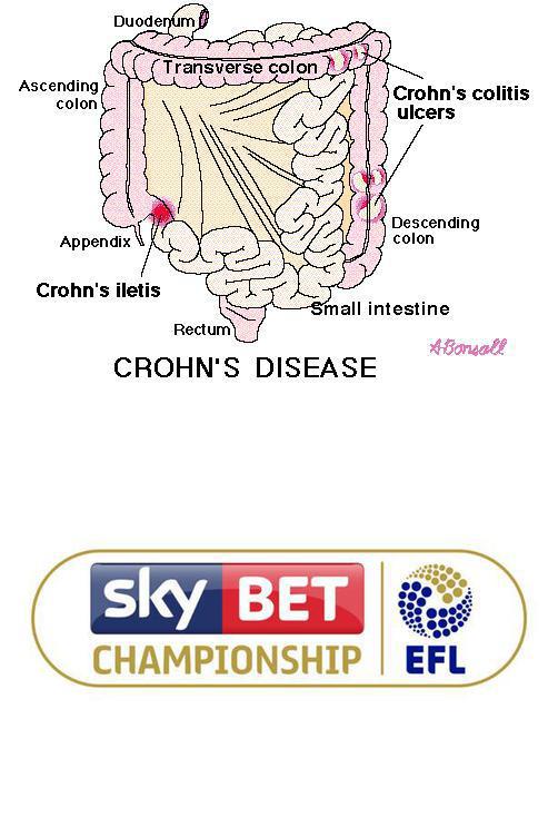 pubnames's tweet image. The #Ileitis and #Championship