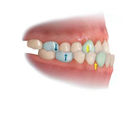 GrupoMandarine's tweet photo. La cirugía maxilofacial se creó para aliviar la vida de pacientes que no oueden comer o sonreír bien por problemas en su mordida. #salud https://t.co/gdAyzcF3DY