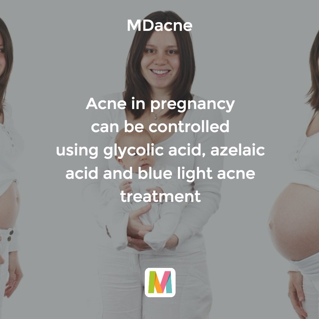 MDacne's tweet photo. #acne in #pregnancy can be controlled
using #glycolic acid, #azelaic acid and #blue light acne treatment. https://t.co/I8N2fmB50W https://t.co/bSGVjquhA6