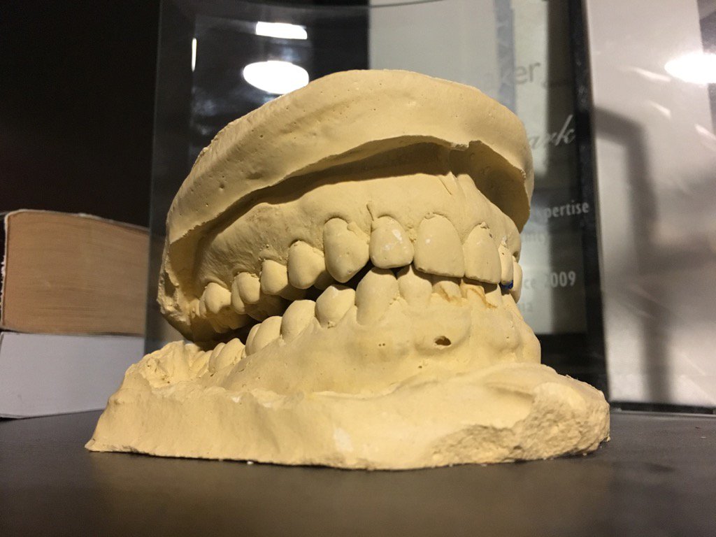 trdshow's tweet photo. Here's that mold of my teeth I mentioned on this weeks episode ^js https://t.co/kkW8PKOtRL