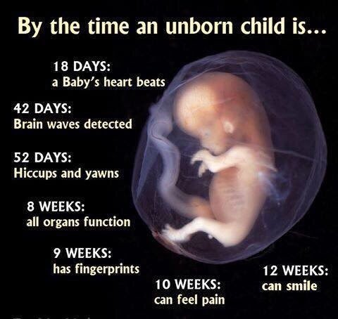 andersonDrLJA's tweet photo. Do You Still Think That a #Emryo is Just A Clump of Cells?
#WakeUpAmerica! #ProLife #AllLivesMatter #StopAbortions #DefundPlannedParenthood https://t.co/GJ4kz0KHv9