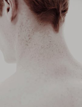 ❝Everyone expects me to do as well as the others, but if I do, it's no big deal, because they did it first.❞