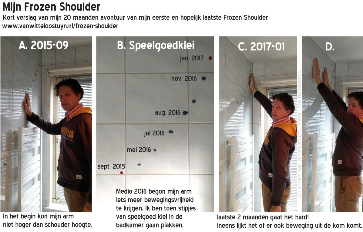 Mijn 20 maanden #frozenshoulder beschreven. vanwitteloostuyn.nl/frozen-shoulde… #schouder #komtgoed #fysio #dryneedling
