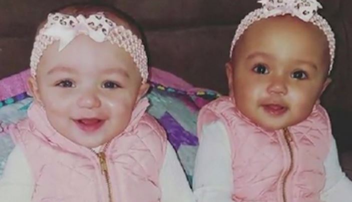 Twin baby girls born with different skin colors bit.ly/2kIg1xi https://t.co/HPkIPkoewP