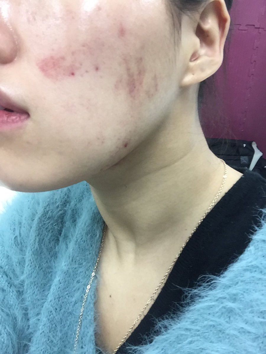 女子プロレスラー 夏すみれさんの いくら顔面殴られても大丈夫 なメイク術が魔法みたいでときめく Togetter 女子プロレスラー 夏すみれさんの いくら顔面殴られても大丈夫 なメイク術が魔法みたいでときめく Togetter