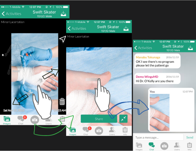 Why We Developed ZoomShare for BodyMapSnap: ow.ly/y8No308HWH6 #mhealth #digitalhealth