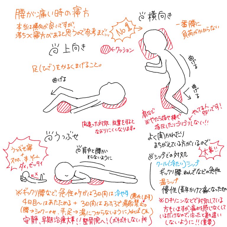 神経痛 運動 坐骨