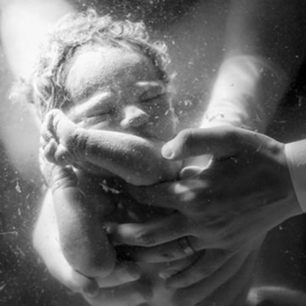 fitpregnancy's tweet photo. Photos show what childbirth *really* looks like https://t.co/9d1ZeHMJ76 https://t.co/w0wcfx69YF