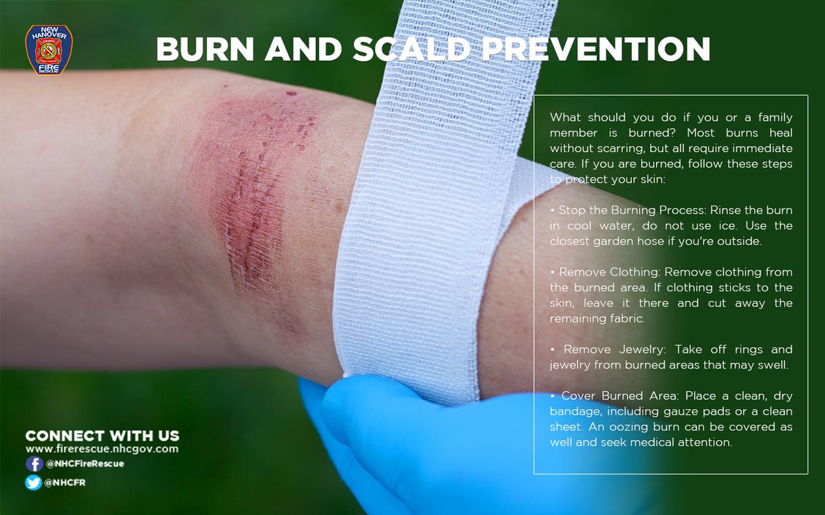 NHCFR's tweet photo. #DYK Its #BurnPreventionWeek. Here are some tips to help keep your little ones safe. #BeSafe #SafetyFirst #NHCFR https://t.co/tBWAz63BL5
