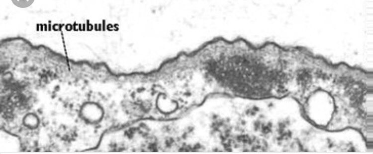 DLSMicrotubules's tweet photo. This is a microtubule under a microscope. How dope https://t.co/htaqrgNnSn