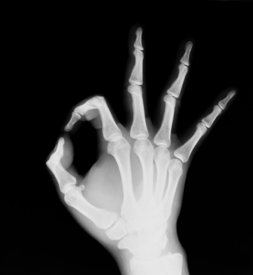 DirectOrthoCare's tweet photo. Broken bone? You can skip the ER. Really. #GoSeeDOC https://t.co/UwCCbHNazG