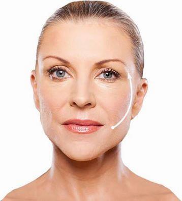 HBHealthClinic's tweet image. SAGGY SKIN NO MORE! #silhouettesoft #SkinRenewal #facialthreads #antiageing hbhealthofknightsbridge.co.uk/thread-lift/