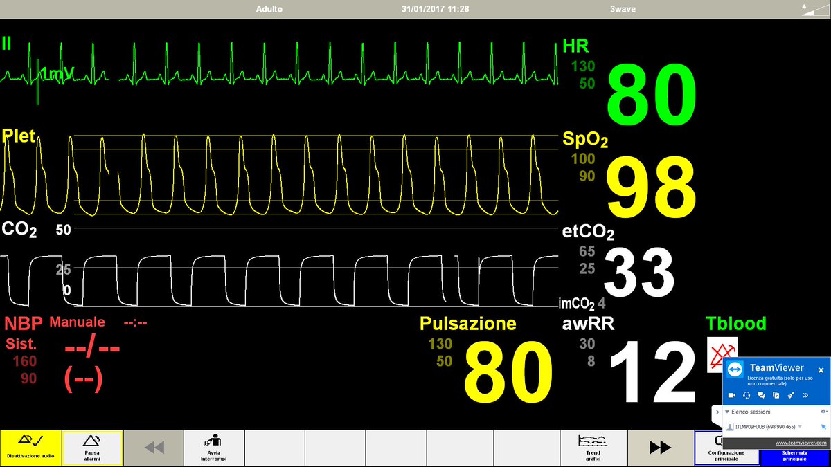 PecoraNera1's tweet image. Remote Support on #LLEAP Patient Monitor with @SimoneProletti 
Thanks to @TeamViewer 👍👍👍