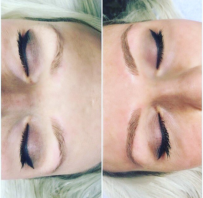 caleereed's tweet photo. Ever wondered what getting a tattoo on your face would feel like? Read about my experience: https://t.co/5xXIC4J2Y2 https://t.co/DgN9DOimPb