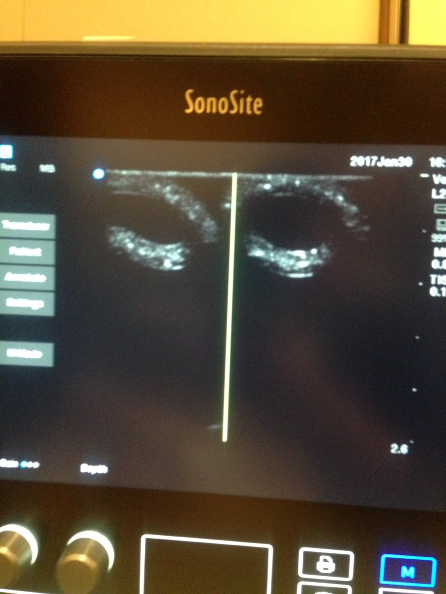 GalwayICAPSS's tweet photo. Making ultrasound compatible task trainers from basic ingredients at #IMSH2017 @DrDaraByrne @PatientSafetyIE https://t.co/CshxB0L5uS