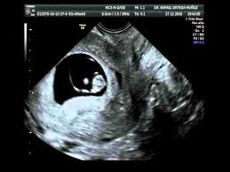 Un buen día para nosotros👶 Sano y fuerte❤💪 #MiAngel😇 Gracias por acompañarme <a href="/GerardoOtero19/">Gerardo Otero</a> Te amo❤