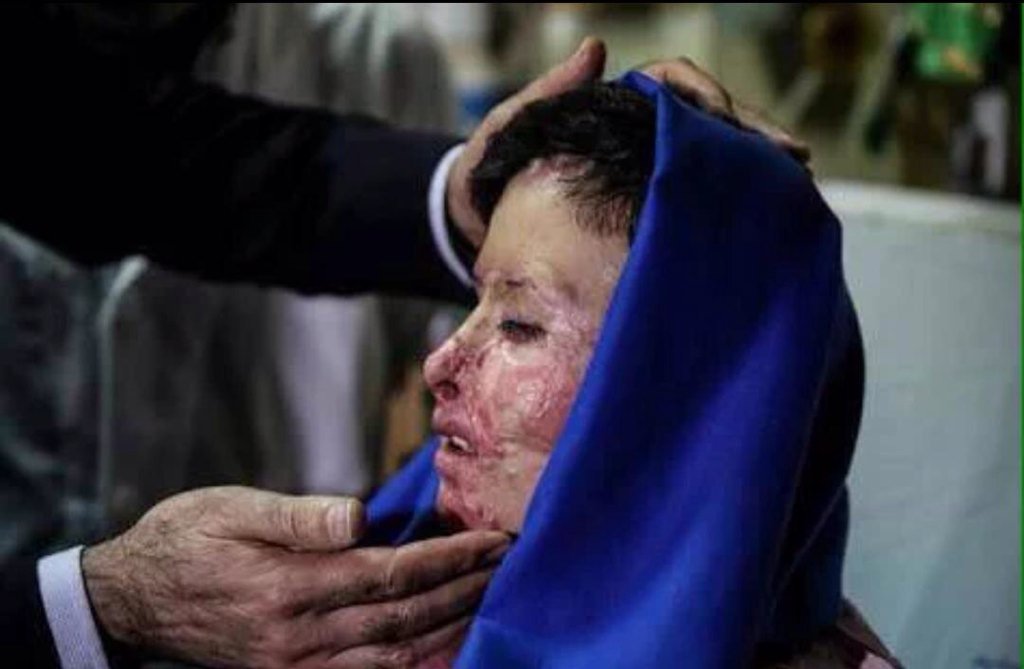 tijeroam's tweet photo. @francediplo @jeanmarcayrault @JZarif
دیپلماسی شما می توانید مسیر دلیل.
رایگان بی گناه.
#iran
#SaveArash
#SOSAli https://t.co/30MOO50Wlq