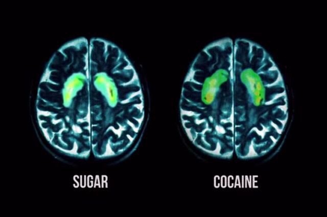 Нужен ли сахар мозгу. Нужен ли сахар мозгу. Еда полезная для мозга. Глюкоза для мозга. Глюкоза для мозга.